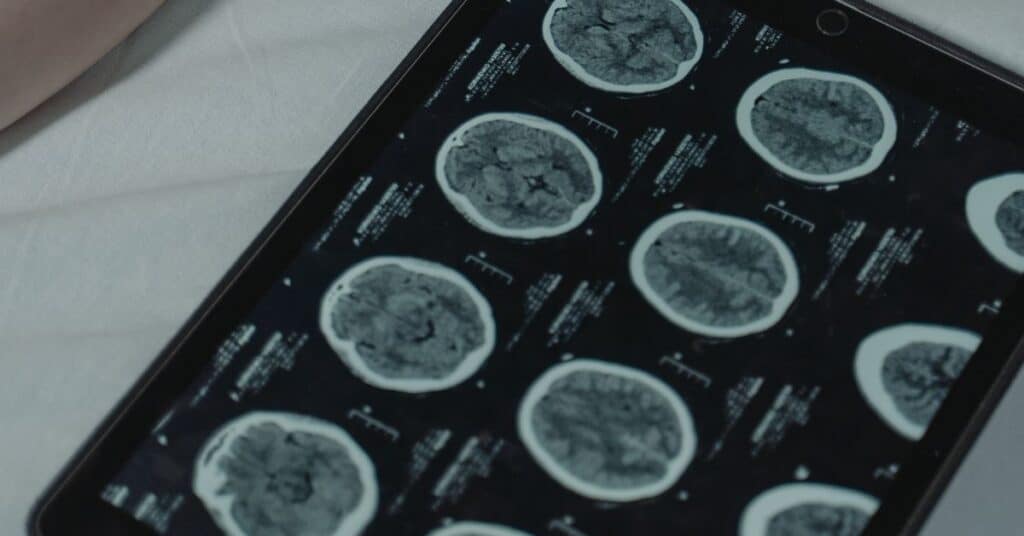 An ipad with images of brain scans on it